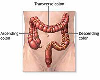 Colon Cleansing
